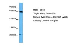 TMEM87B Rabbit anti-Mouse, Polyclonal, Novus Biologicals 0.1 mL | Buy Online | Novus Biologicals | Fisher Scientific